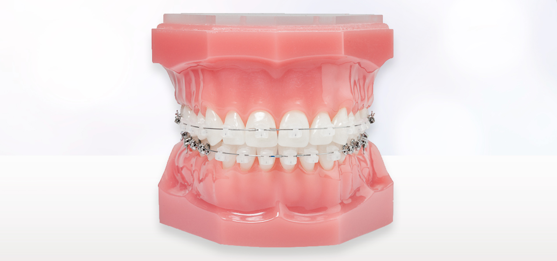 「痛みや不快感を軽減」効率的に歯を動かす治療システム